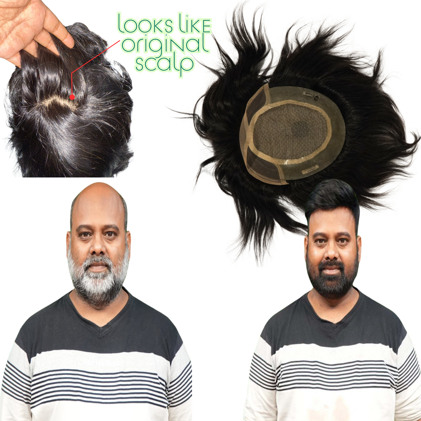 Miraj Front Lace Hair Patch – Natural Human Hair | Real Scalp Look | Premium Breathable Multi-Layer Base