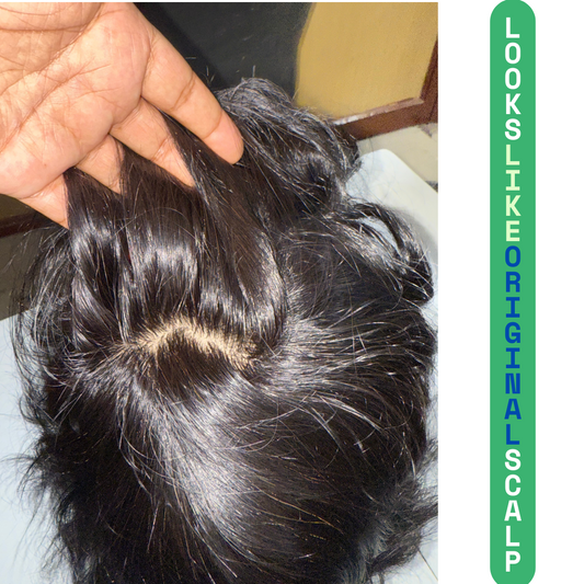 Miraz Hair Patch for Men – Natural-Looking, Breathable & Sweat-Resistant Non-Surgical Hair Replacement by Hair Stream